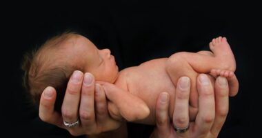 Infant diagnosed with CEP | Porphyria News | hands holding a newborn