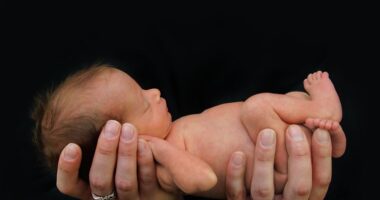 Infant diagnosed with CEP | Porphyria News | hands holding a newborn