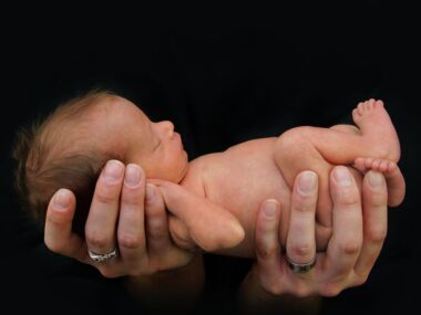 Infant diagnosed with CEP | Porphyria News | hands holding a newborn