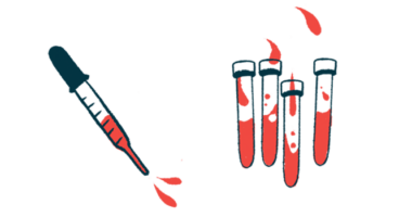 A squirting pipette is pictured alongside several vials half filled with a red liquid.