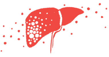 An illustration shows a side view of the human liver.