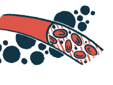 Illustration of blood cells moving through a blood vessel, representing blood pressure and cardiovascular changes in AIP.