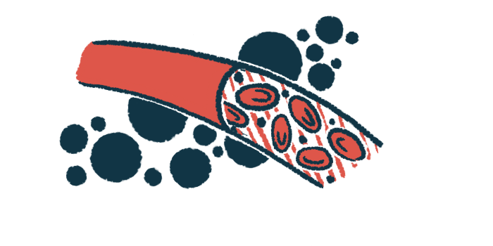 Illustration of blood cells moving through a blood vessel, representing blood pressure and cardiovascular changes in AIP.